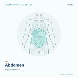 Resonancia Magnética Abdomen
