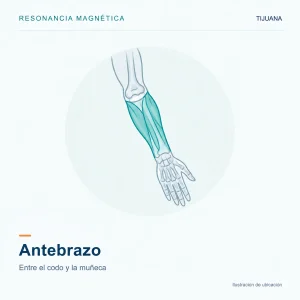 Resonancia Magnética Antebrazo