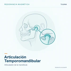 Resonancia Magnética Articulación Temporomandibular