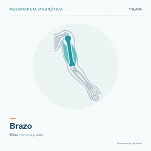 Resonancia Magnética Brazo