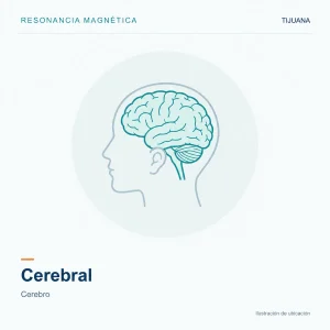 Resonancia Magnética Cerebral