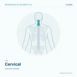 Resonancia Magnética Cervical