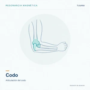 Resonancia Magnética Codo
