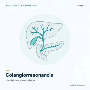 Resonancia Magnética Colangiorresonancia