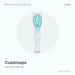 Resonancia Magnética Cuádriceps