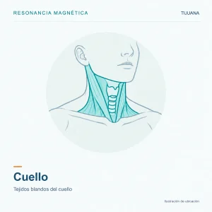 Resonancia Magnética Cuello