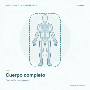 Resonancia Magnética Cuerpo Completo