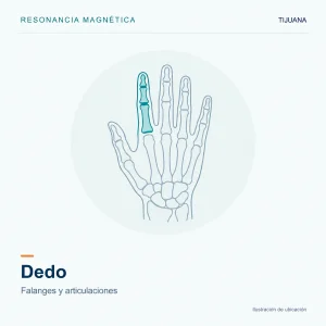 Resonancia Magnética Dedo