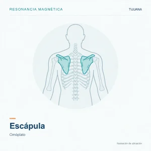 Resonancia Magnética Escápula