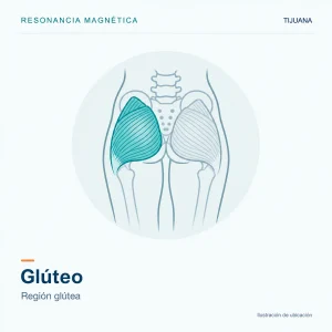 Resonancia Magnética Glúteo