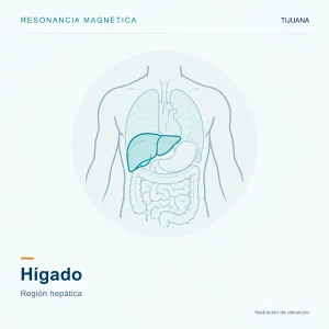 Resonancia Magnética Hígado