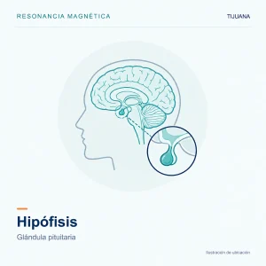 Resonancia Magnética Hipófisis