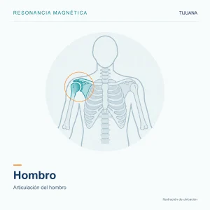 Resonancia Magnética Hombro