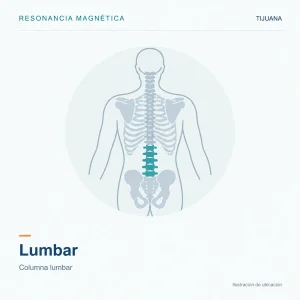 Resonancia Magnética Lumbar