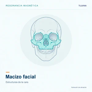 Resonancia Magnética Macizo Facial