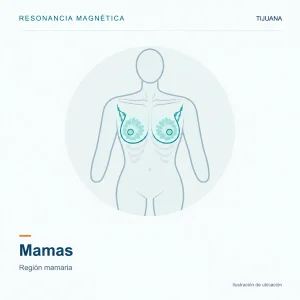 Resonancia Magnética Mamas