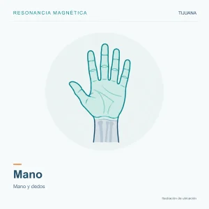 Resonancia Magnética Mano