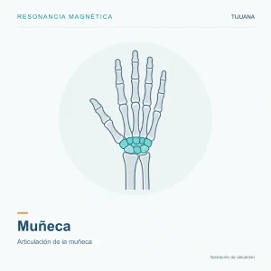 Resonancia Magnética Muñeca
