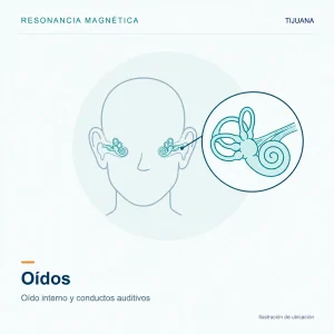 Resonancia Magnética Oídos