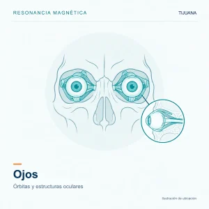 Resonancia Magnética Ojos