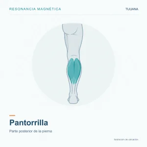 Resonancia Magnética Pantorrilla