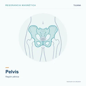 Resonancia Magnética Pelvis