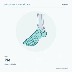 Resonancia Magnética Pie