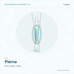 Resonancia Magnética Pierna