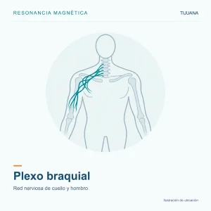 Resonancia Magnética Plexo Braquial