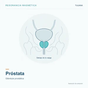 Resonancia Magnética Próstata