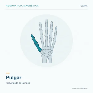 Resonancia Magnética Pulgar