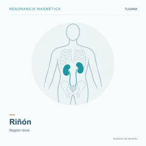 Resonancia Magnética Riñon
