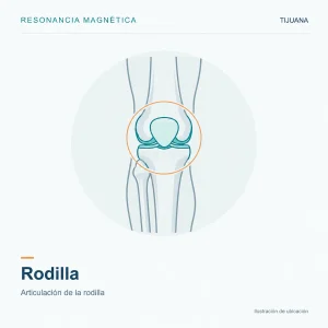 Resonancia Magnética Rodilla