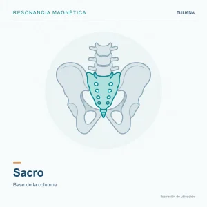 Resonancia Magnética Sacro