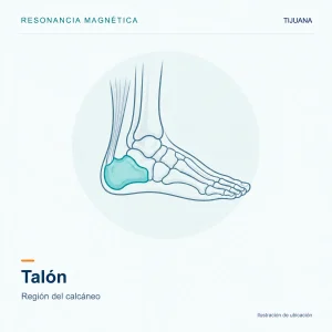 Resonancia Magnética Talón