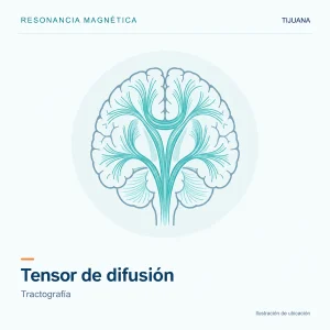 Resonancia Magnética Tensor de Difusión con Tractografía