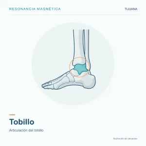 Resonancia Magnética Tobillo