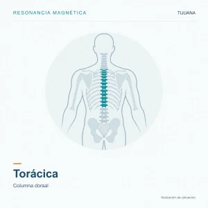 Resonancia Magnética Torácica