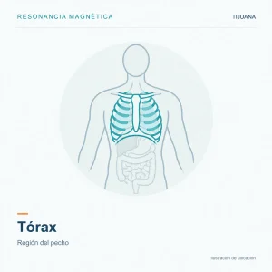 Resonancia Magnética Tórax