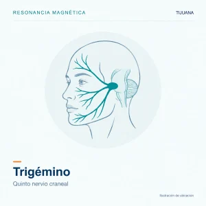 Resonancia Magnética Trigémino